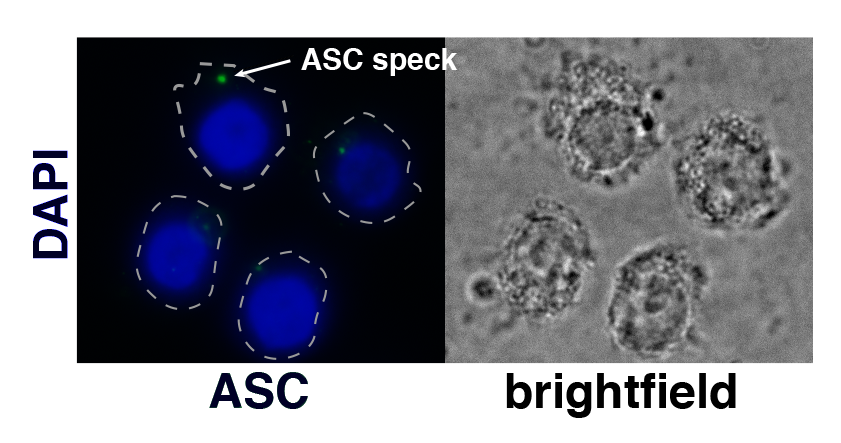 Image of four macrophages undergoing pyroptosis. Detected by green fluorescence signal are ASC specks in the macrophage cytosol.